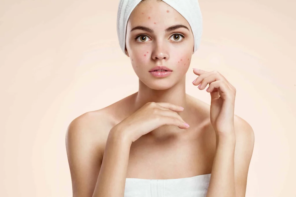 PRP Therapy in Langhorne, PA | Dermalign MedSpa