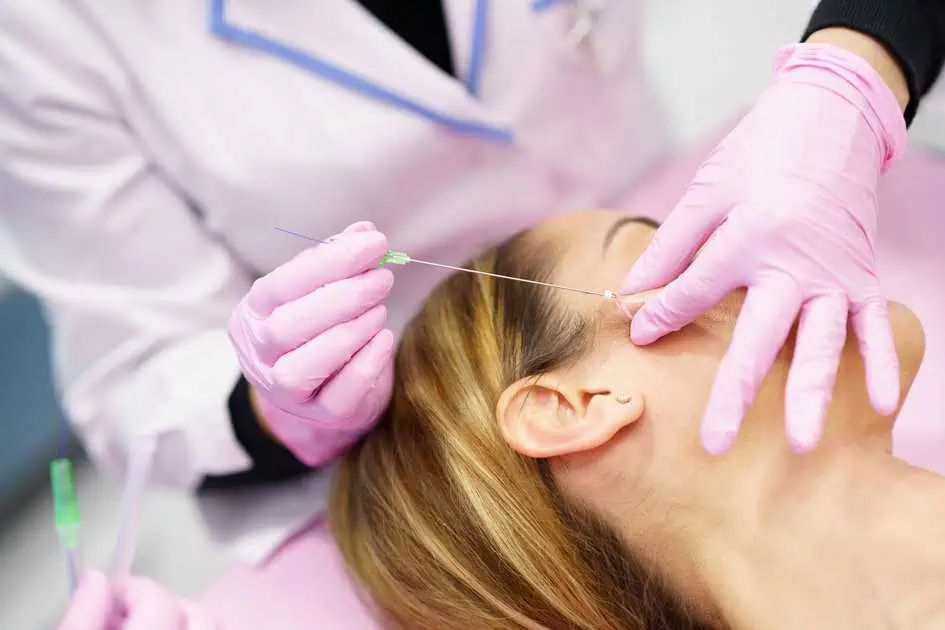 PDO-Thread-Lifts-treatment-in-Langhorne-PA-by-Dermalign-Medical-Aesthetics