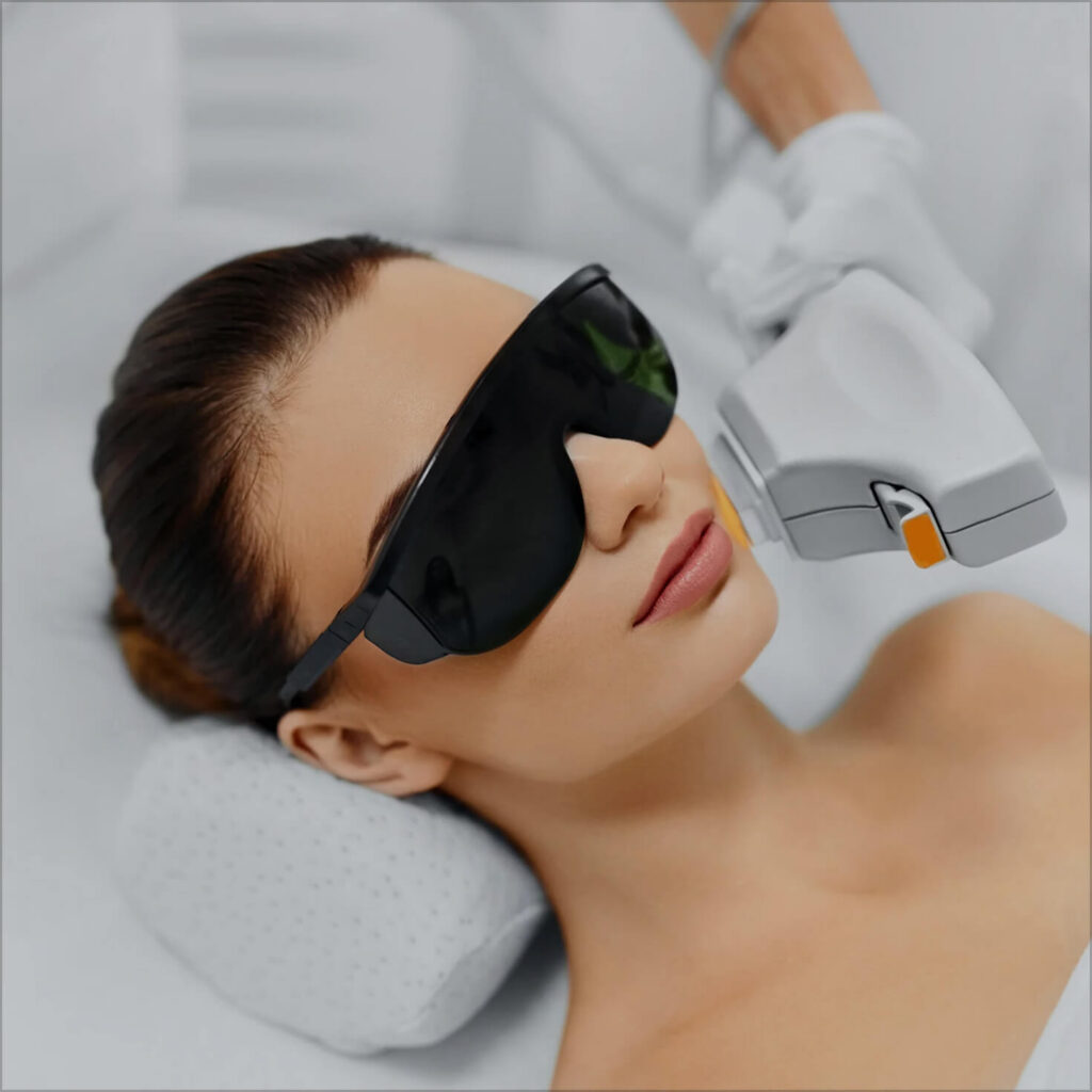 PRP Facial 2