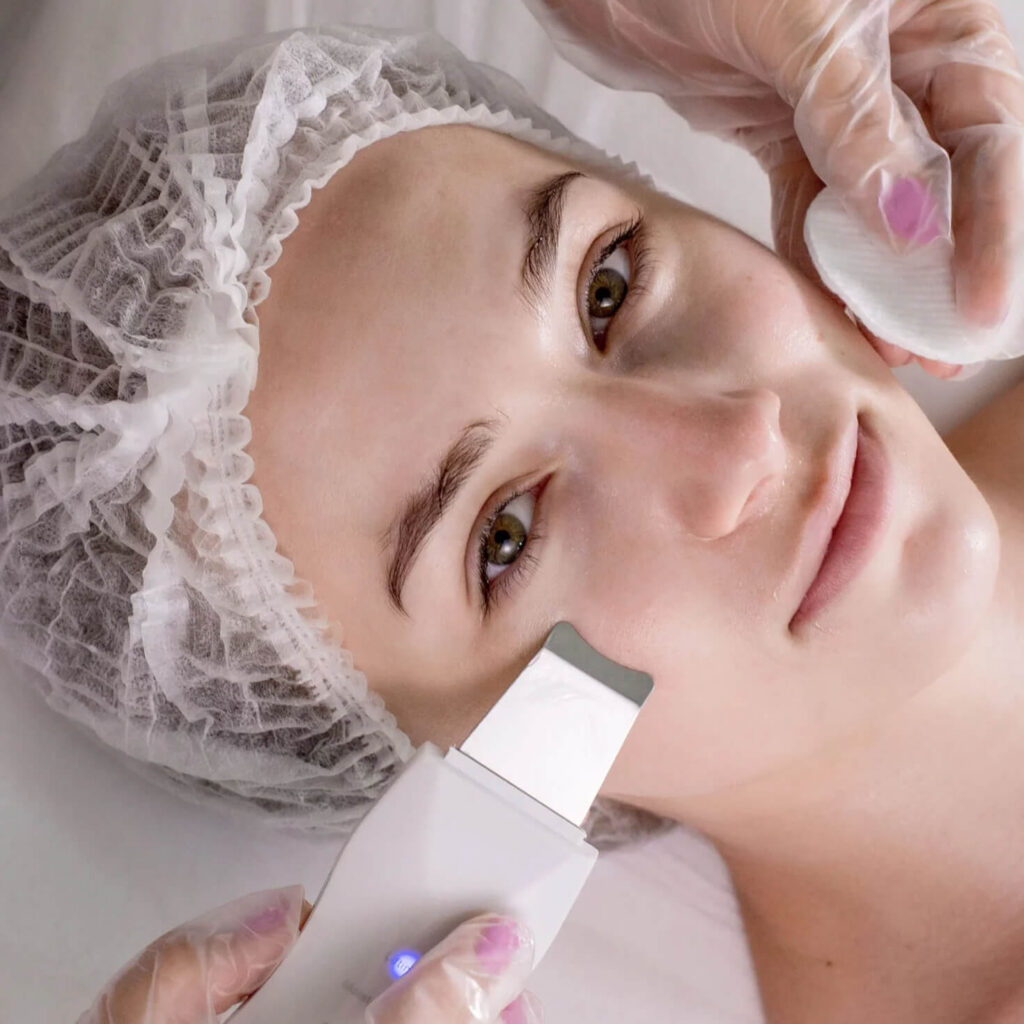 PRP Facial