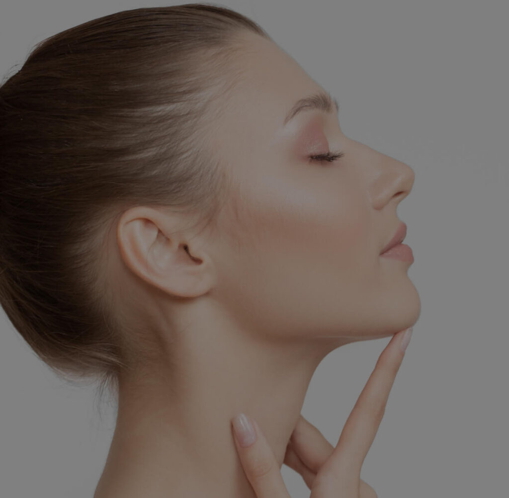 Kybella