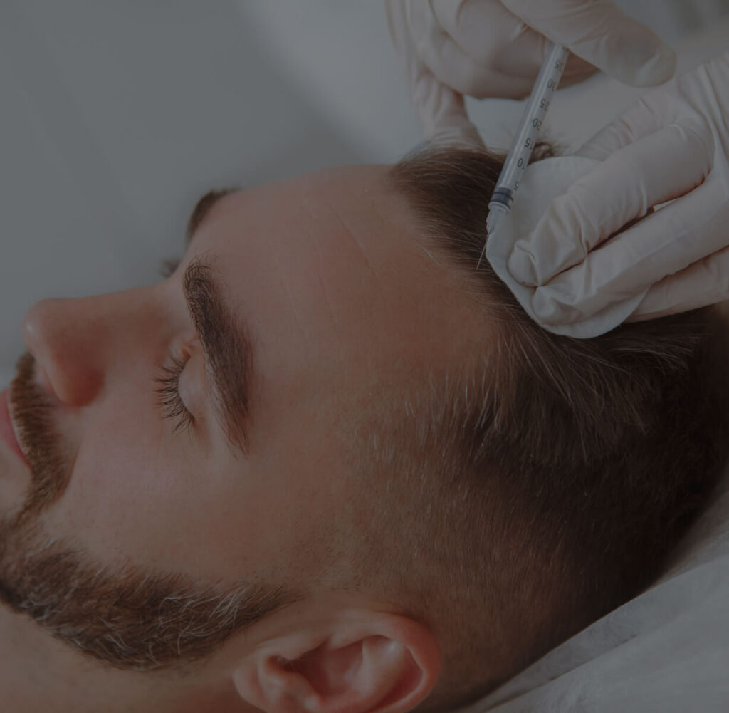 Men’s PRP Hair Restoration
